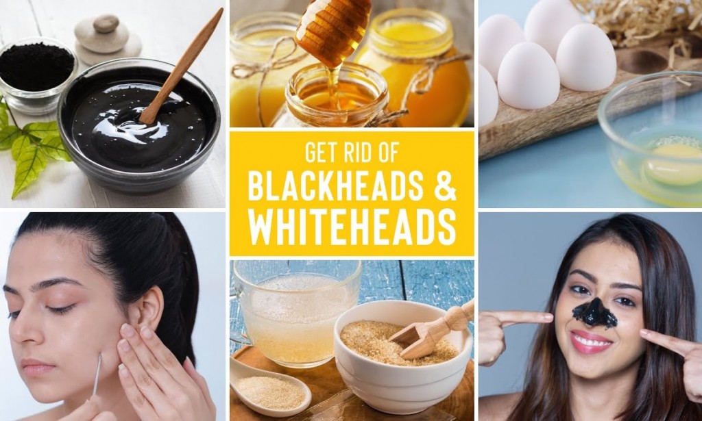 Home Remedies for Blackheads