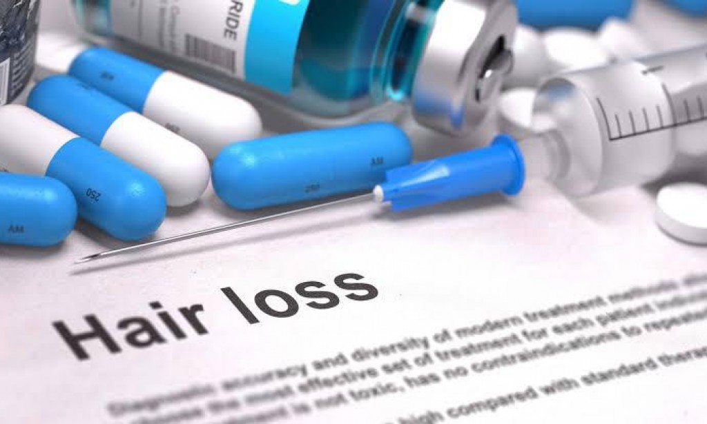 Best Hair Loss Treatment for Female Home Remedy