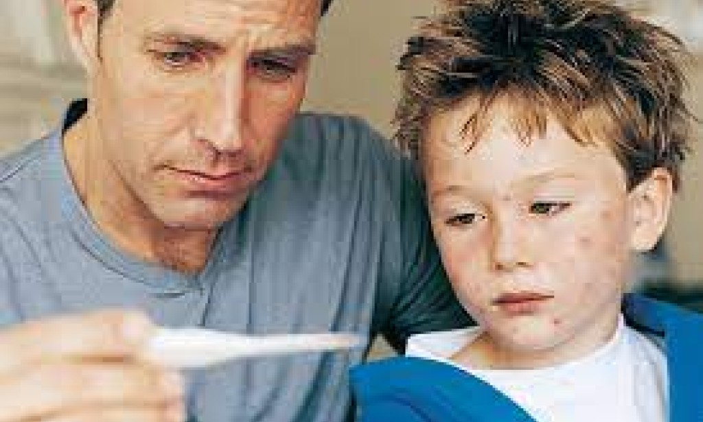 Understanding Chickenpox: Symptoms, Treatment, and Prevention