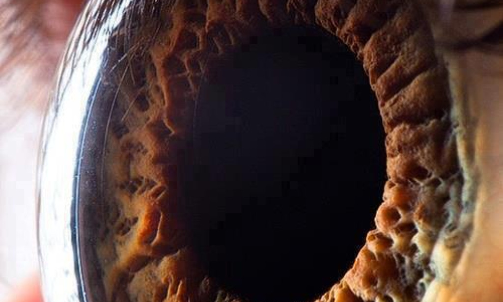 Examining the Area of Eye Pollutions: Making heads or tails of, Balance, and Treatment