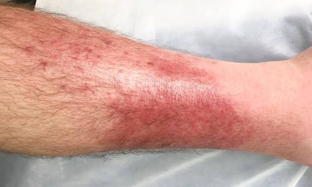 Skin Conditions One Should Know About