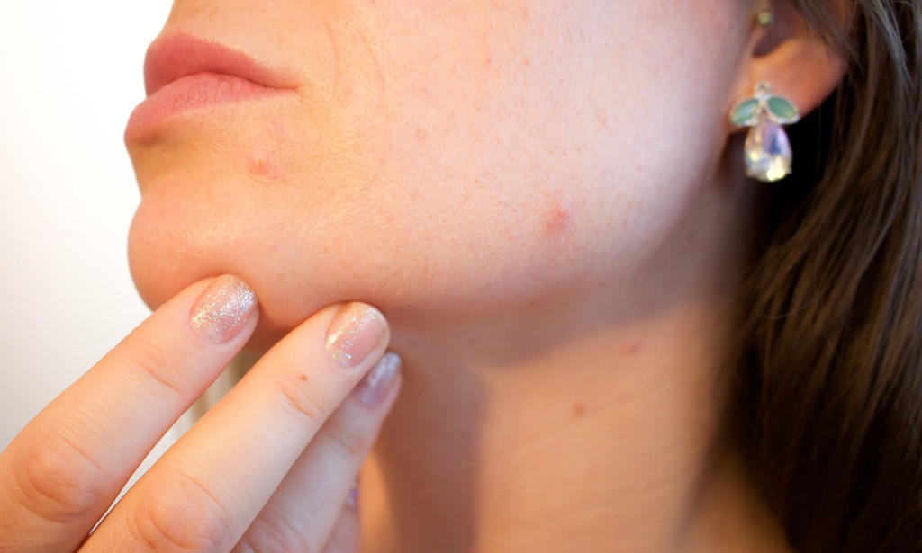 Sorting out Ordinary Skin Ailments: Causes, Incidental effects, and Drugs