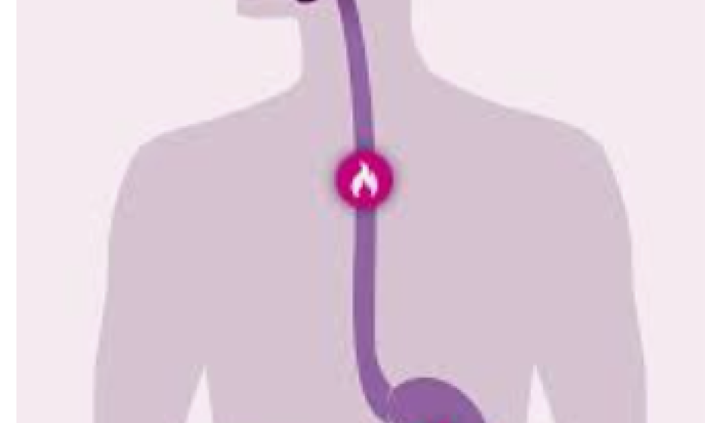 Indigestion/stomach problem. Functional Dyspepsia  Functional dyspepsia is a common chronic problem of the stomach or upper abdomen.