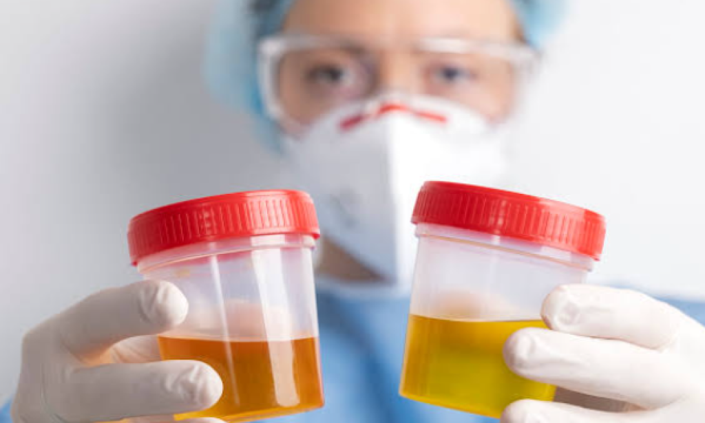 💢 *The shade of pee demonstrates your health?*         ⭕ The shade of pee can inform a great deal regarding your