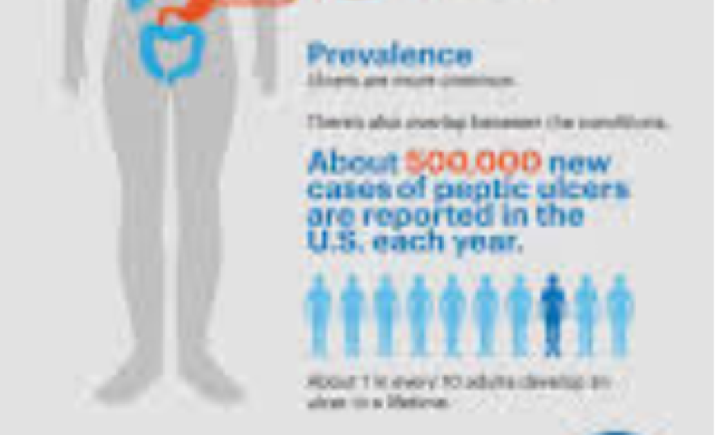 Symptoms of stress-induced gastritis: cause and solution?  Stress-induced gastroritis?