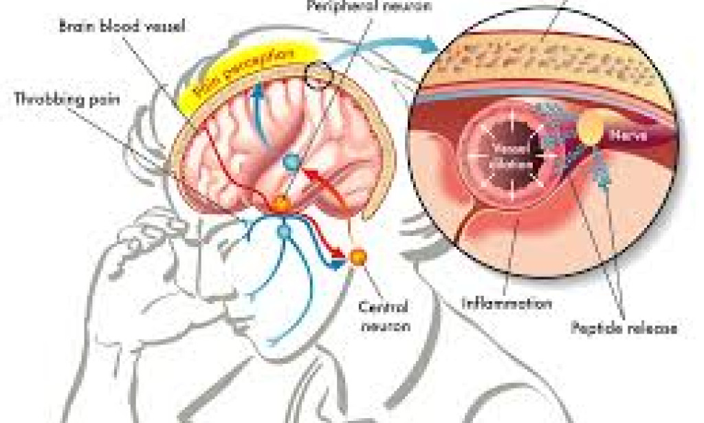 Might Irritation at any point Raise Your Colon Malignant growth Hazard? Another Review Says this