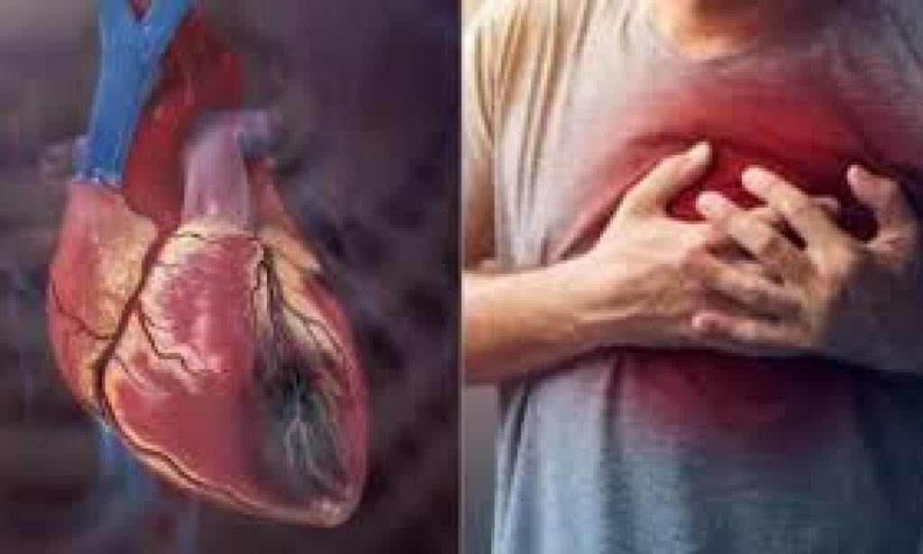 Revealing the Rising Trend: Coronary Disease in Young People