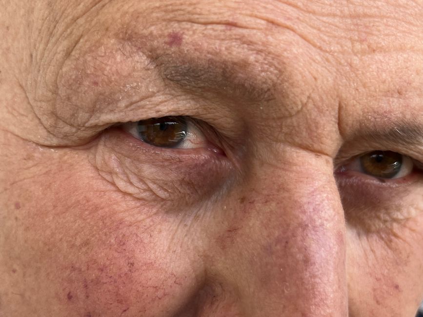 Detailed close-up of a senior man's eyes showcasing wrinkles and age marks.