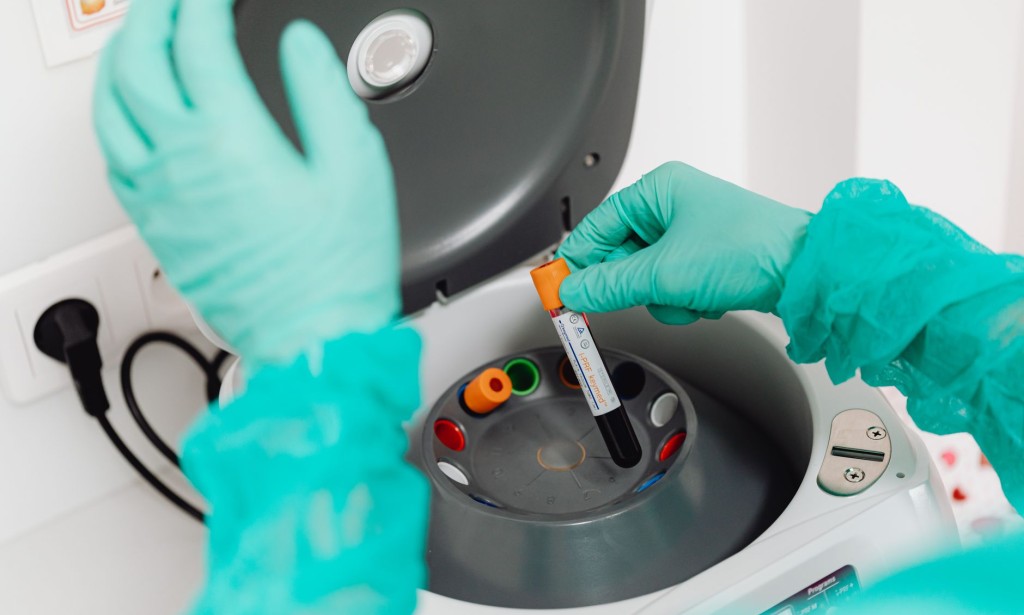 The Bloodhound Sniffs Out Cancer: A New Test Marks a Turning Point