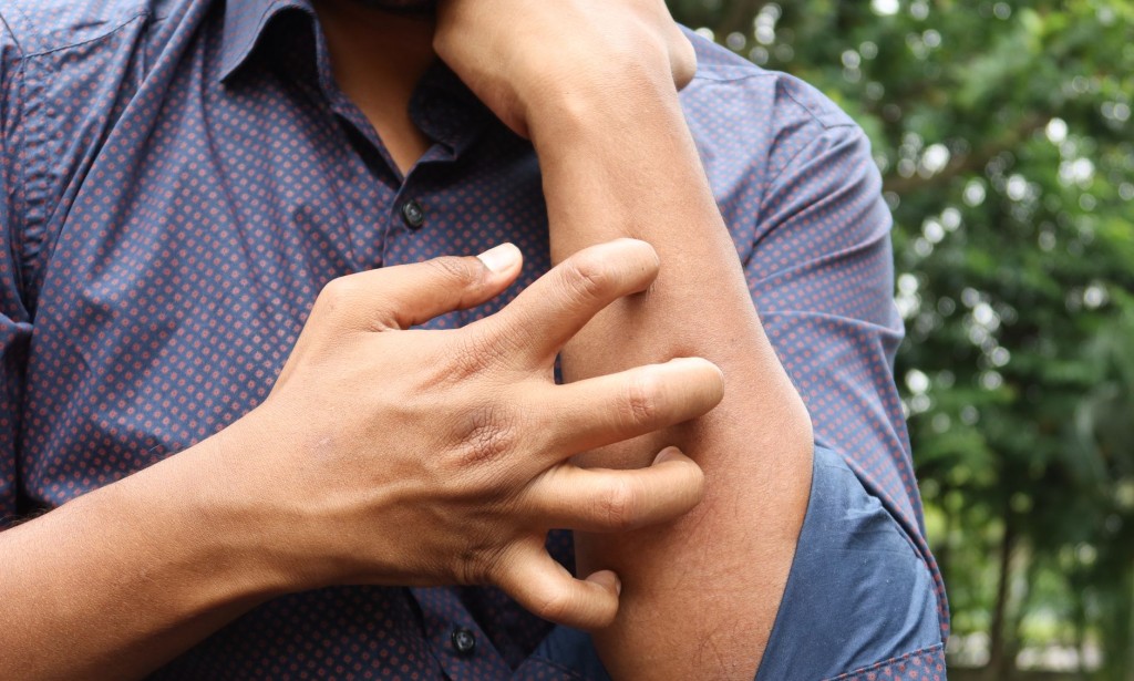 *The most effective method to be protected from heat rash diseases?*